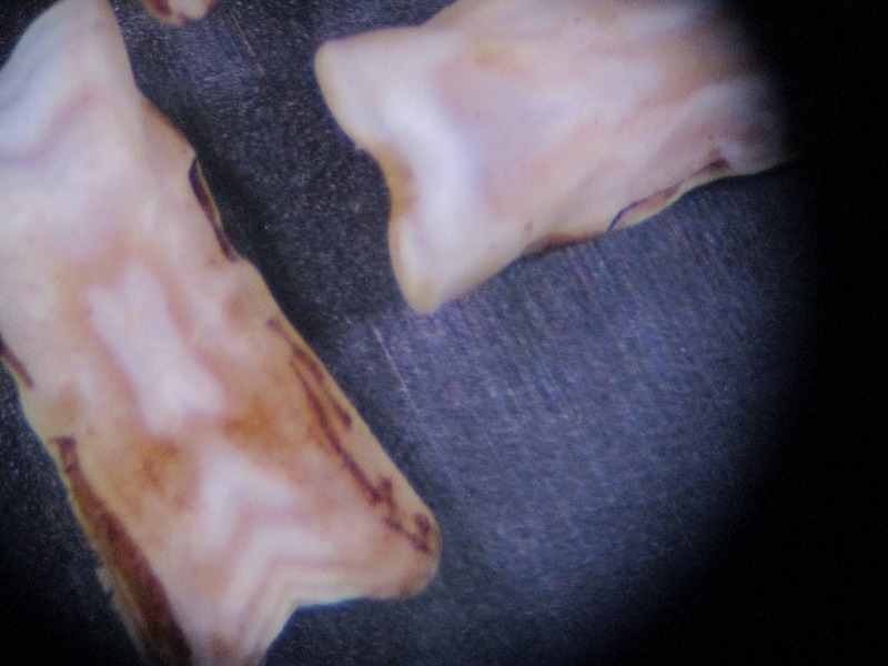 ウニ口器の中間骨